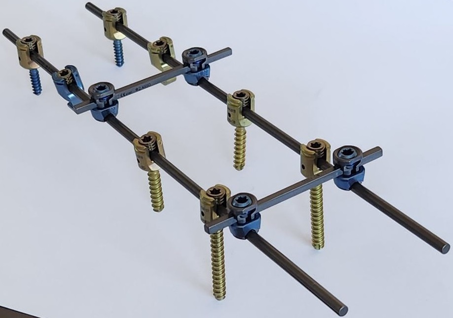 Система для задньої фіксації шийного відділу хребта (4 гвинта) Changzhou Nanxiang Medical Device Co., Ltd.